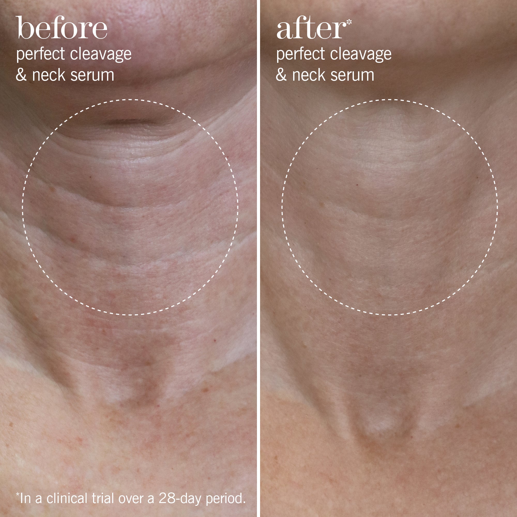 Perfect Cleavage & Neck Serum | Hydrating Neck Cream | This Works