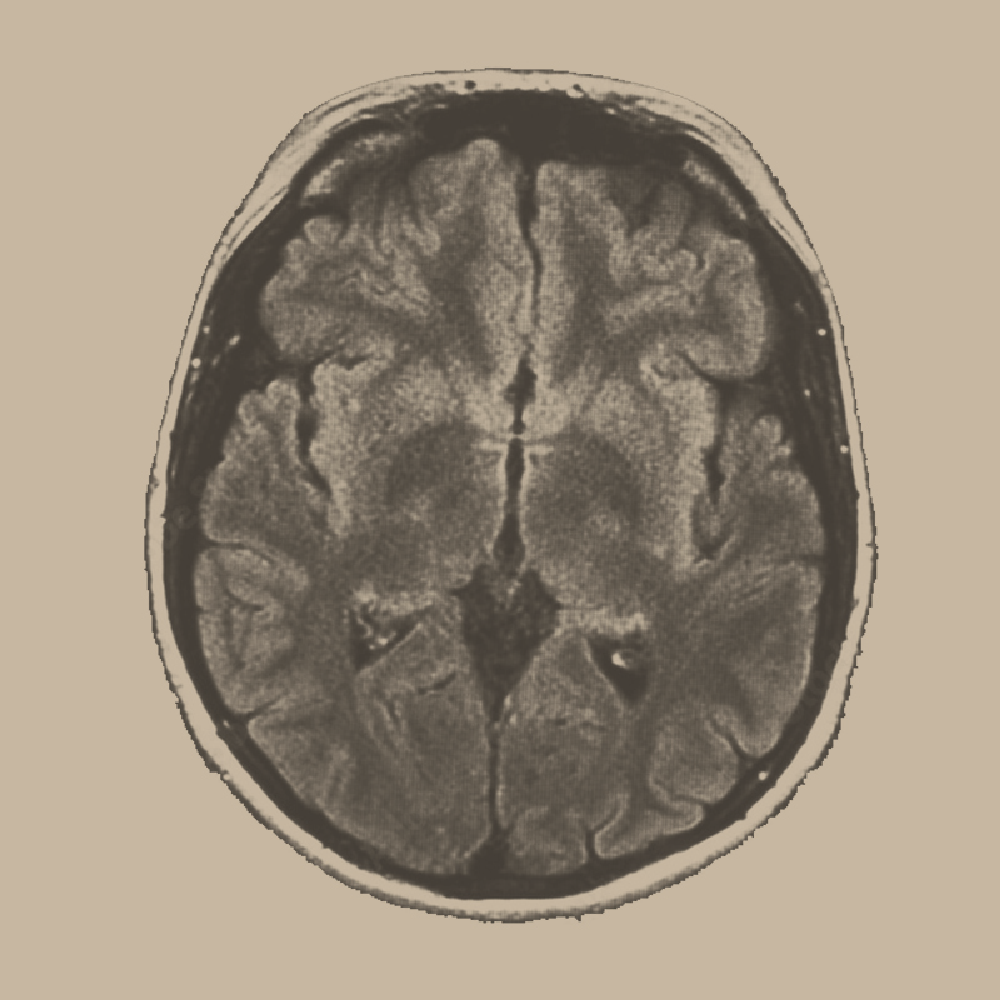 the vagus nerve: a neuroscientist's perspective