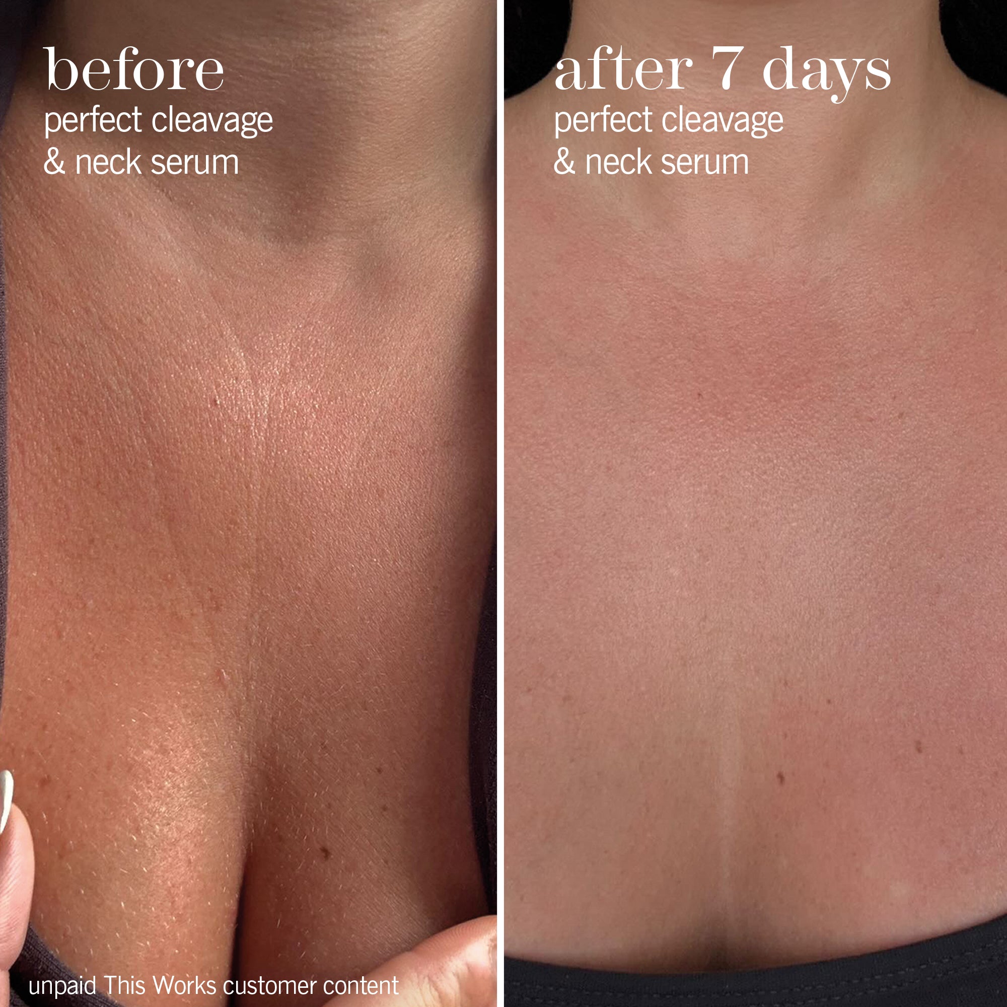 Perfect Cleavage & Neck Serum | Hydrating Neck Cream | This Works