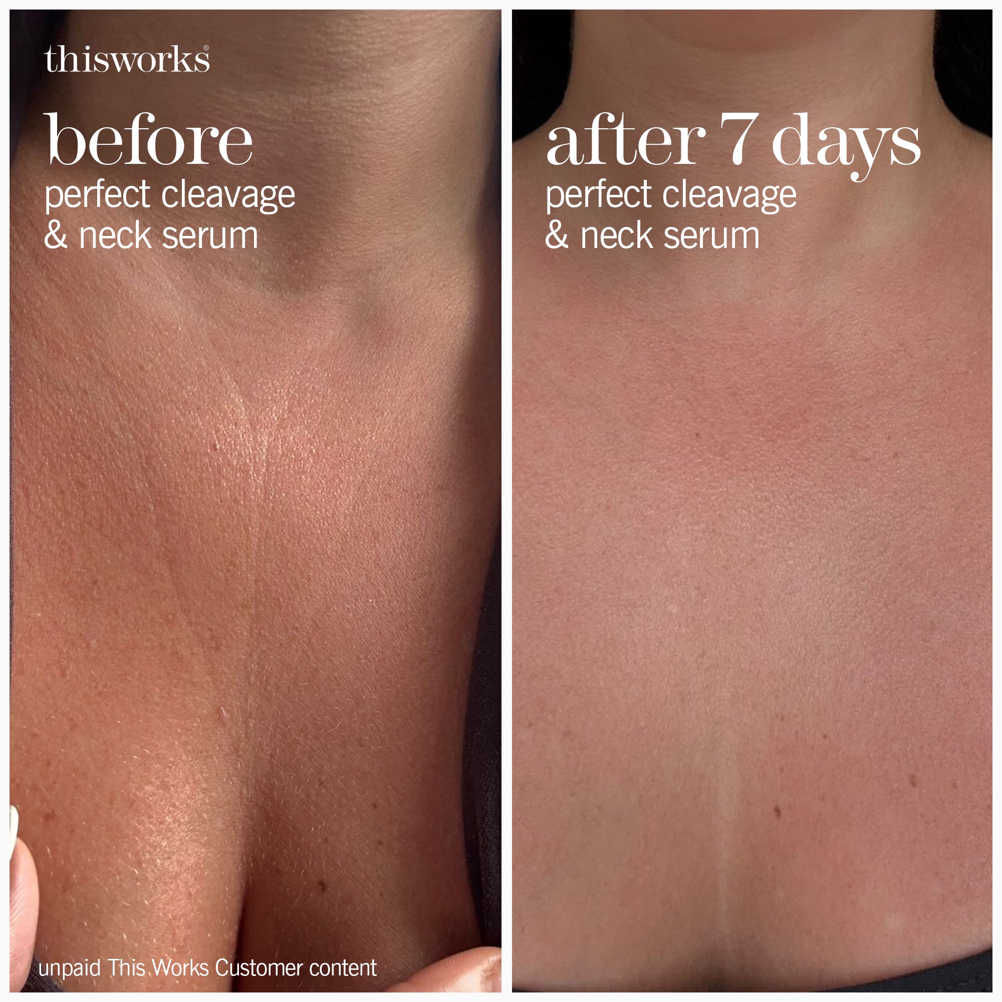 Perfect Cleavage & Neck Serum | Hydrating Neck Cream | This Works